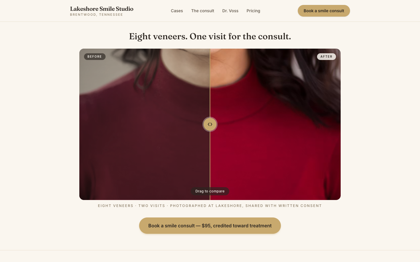 Cosmetic Dental — Smile Makeover Slider — captured preview